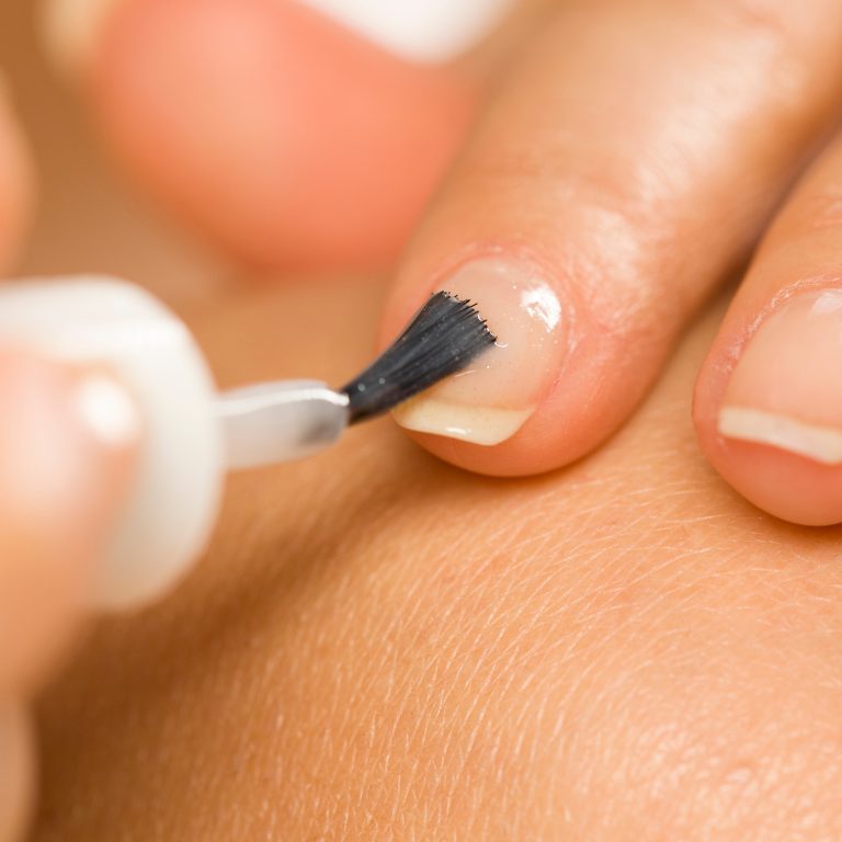 MICOBLOCK ONICODISTROFIE Soluzione ungueale