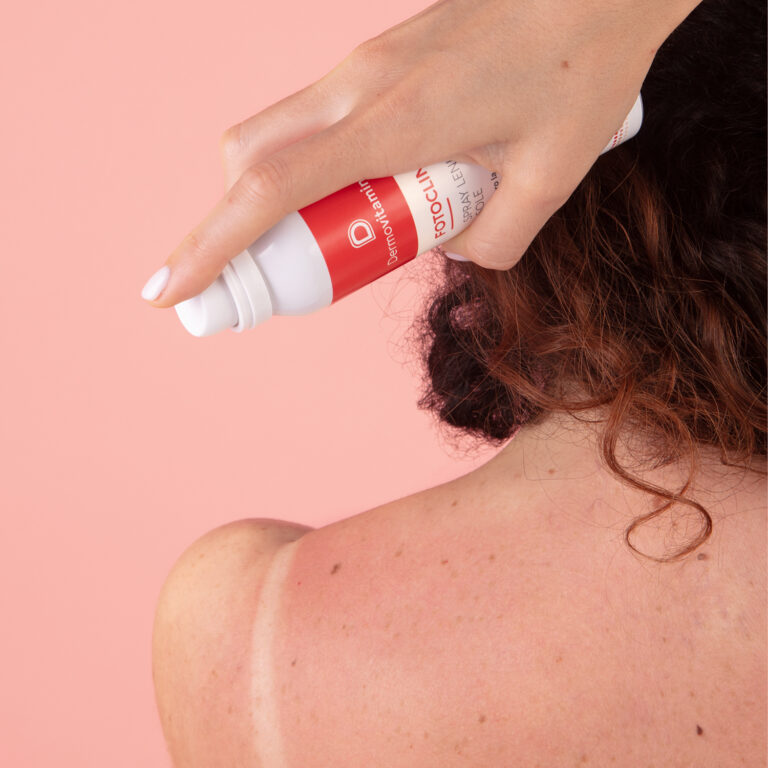 SOS FOTOCLIN SPRAY LENITIVO SOLE