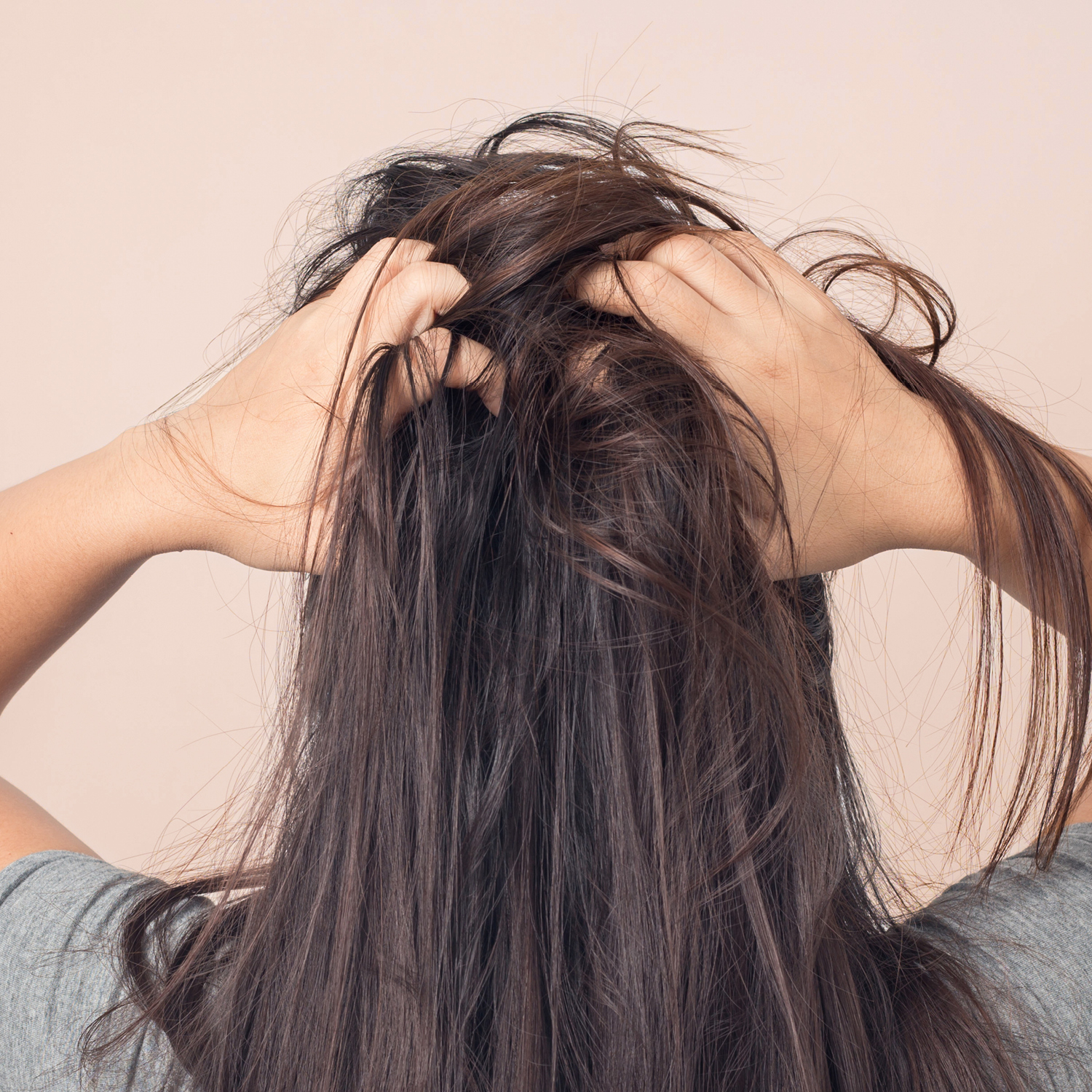 PRURITO SHAMPOO LENITIVO - immagine 2